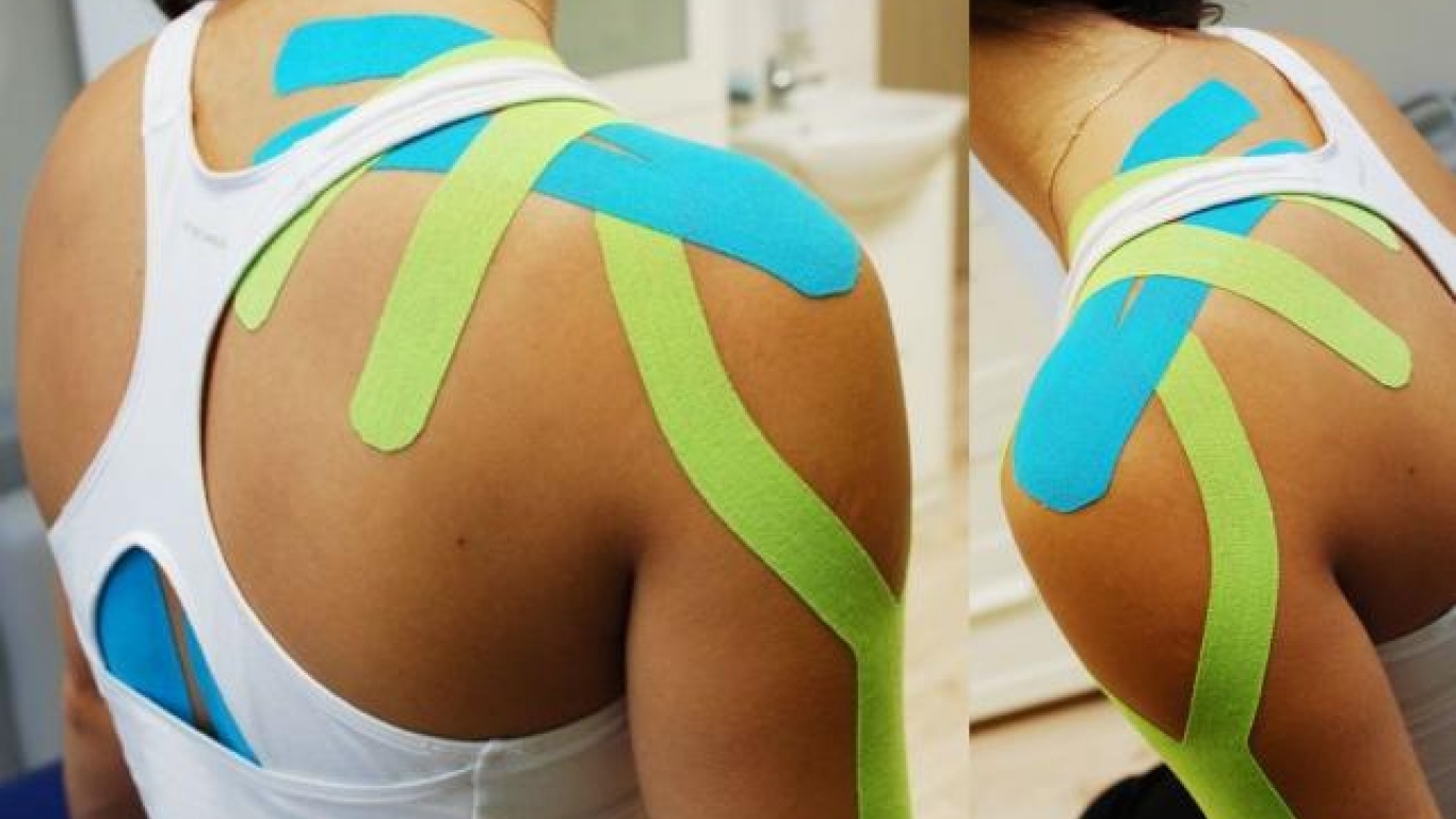 KINESIOTAPING